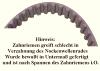 Steuerriemensatz